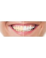 خمیر دندان سفید کننده کلینیکال مدل 3D white Clinical Bright Revival سفید کننده تخصصی - تصویر 3