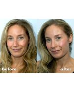 ⁨سرم آبرسان کوزارکس حاوی هیالورونیک اسید - تصویر 3