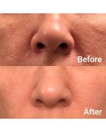 سرم پوست چرب مدیکیوب بستن منافذ باز پوست کنترل چربی و آبرسان پوست - تصویر 2